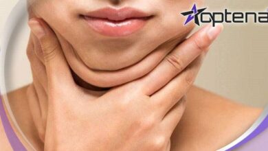 بهترین دکتر رفع غبغب در ایران