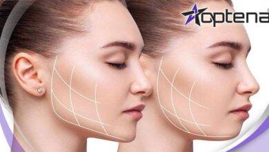 بهترین دکتر بوکال فت در کرج