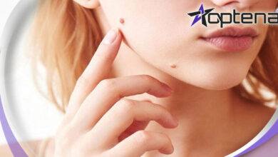 بهترین مرکز خال برداری در ایران