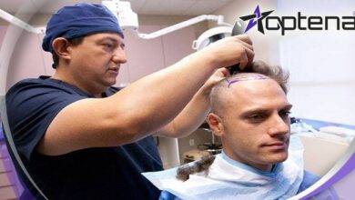 بهترین دکتر کاشت مو در تبریز